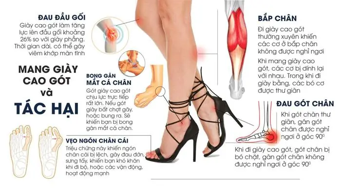 Đi Giày Cao Gót Bị Đau Gót Chân: Nguyên Nhân & 9+ Cách Khắc Phục Hiệu Quả