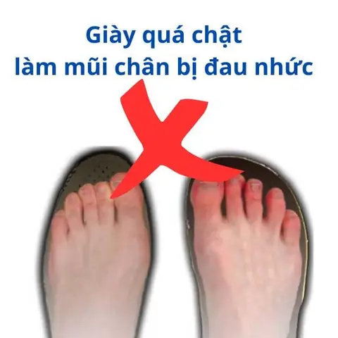 Khoảng Cách Từ Mũi Giày Đến Ngón Chân: Hướng Dẫn Đo Lường & Chọn Giày Vừa Vặn Chuẩn Xác